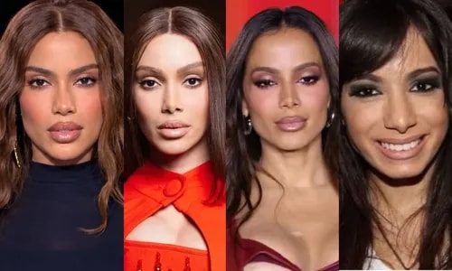 Antes e depois de Anitta em Paris choca web; veja os procedimentos que a cantora já assumiu e quanto custam