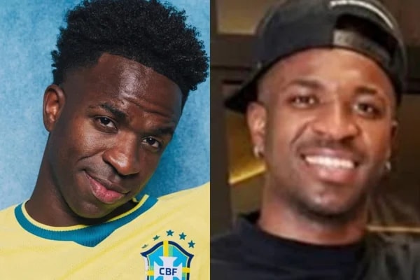 Vini Jr. e outros atletas que "mudaram de CPF" com harmonização facial