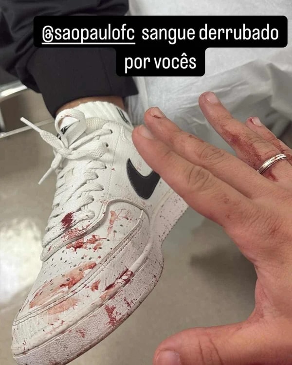 TJSP define pensão para torcedor atingido por placa do Morumbis