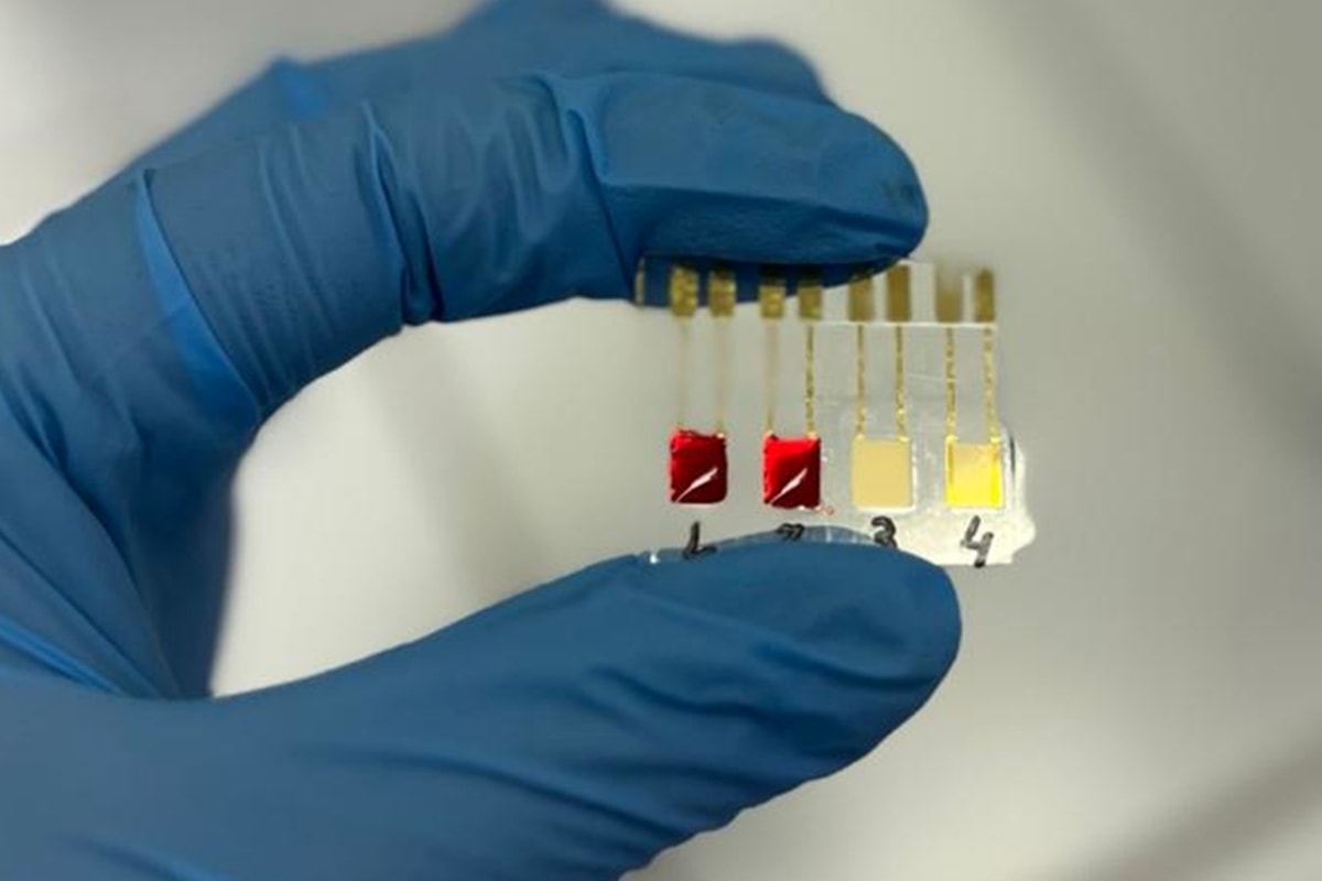 Biossensor brasileiro detecta câncer de pâncreas em fase inicial