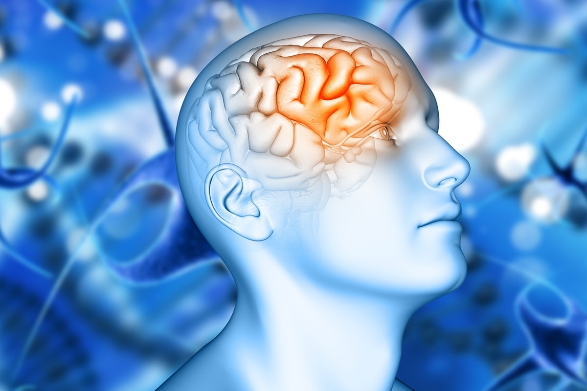 Estudo encontra variante genética que pode triplicar risco de Alzheimer