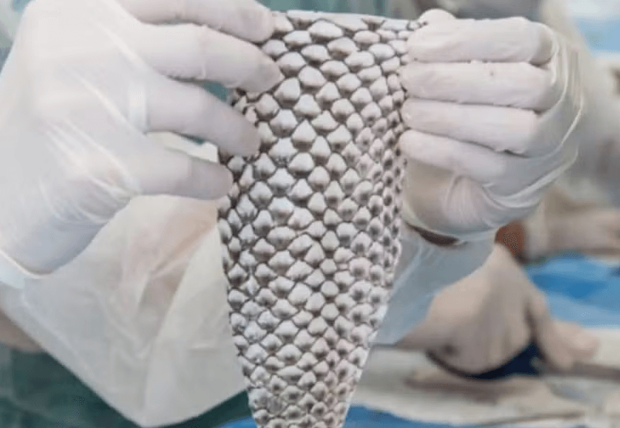Brasil terá primeira fábrica do mundo de pele de tilápia para tratar queimadura