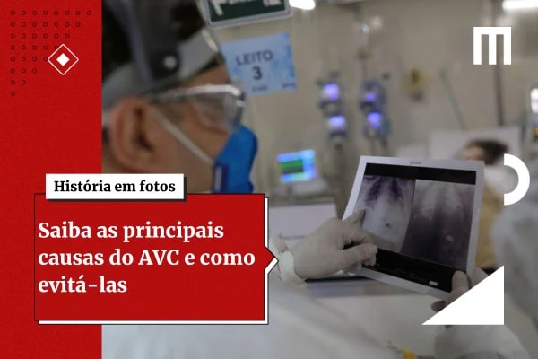 Novo tratamento injetável pode ajudar o cérebro a se recuperar após AVC
