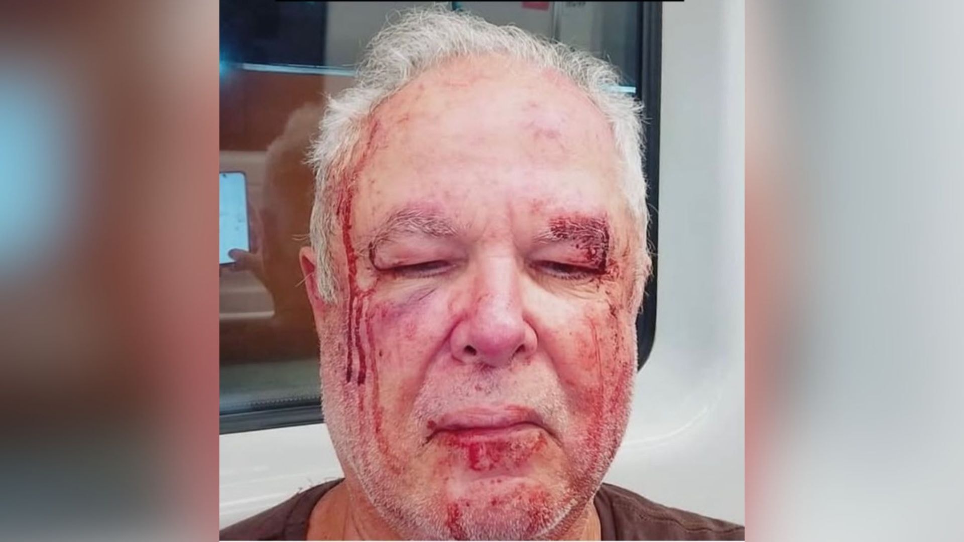 Violência contra idosos cresce 38% no Brasil; especialistas fazem alerta