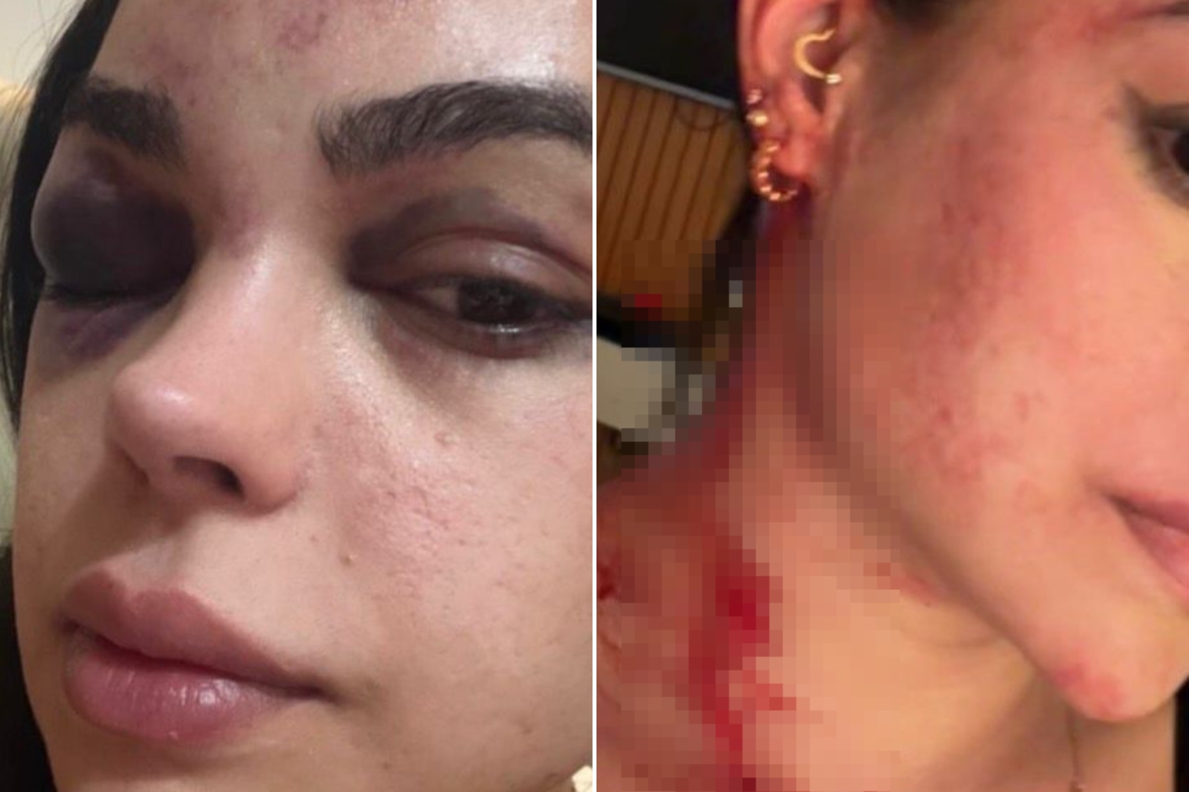 Ex-primeira-dama acusa prefeito de agredi-la na frente do filho de 7 anos
