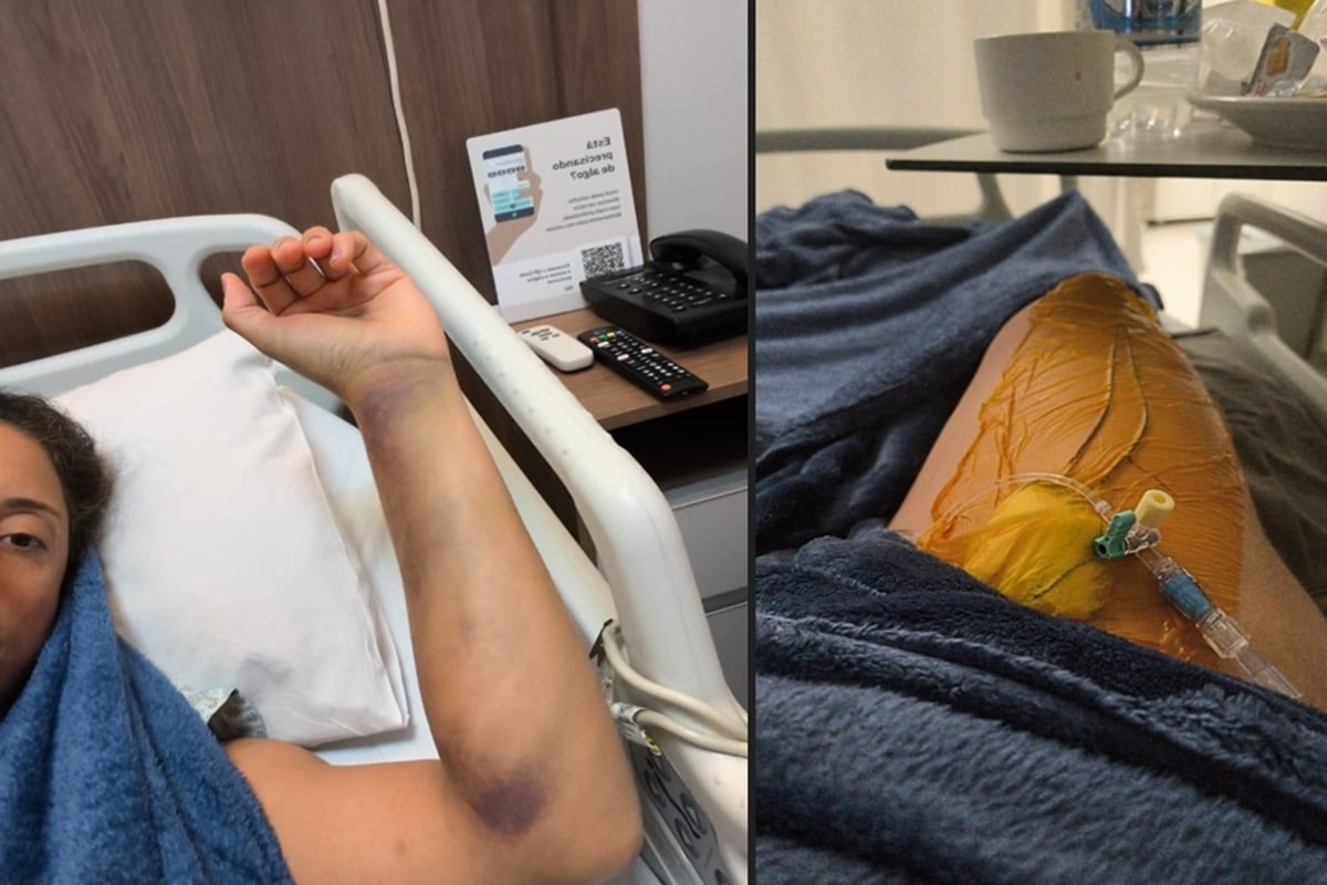 Brasiliense tem tromboembolismo pulmonar após viagem curta de avião