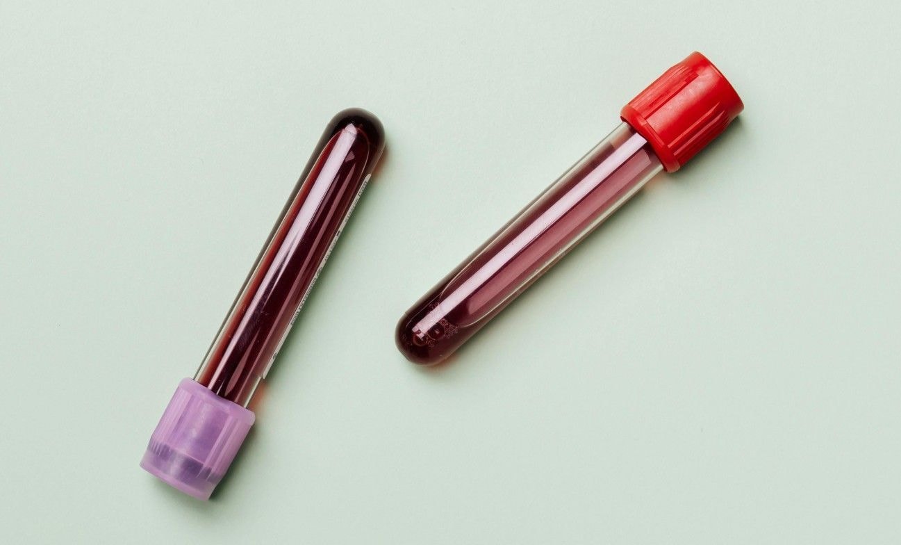 Doação: o sangue que falta não é qualquer tipo