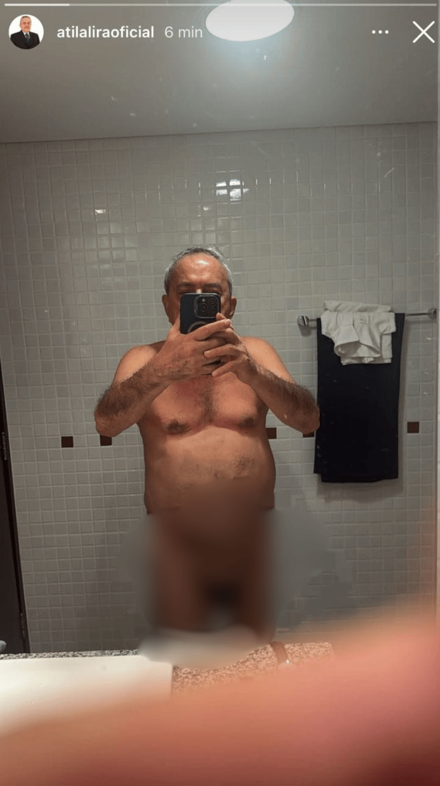 Ex-deputado Átila Lira publica ‘nude’ nas redes sociais