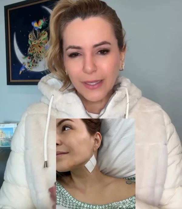 Musa do Carnaval tem nervo facial afetado após retirada de tumor na tiroide