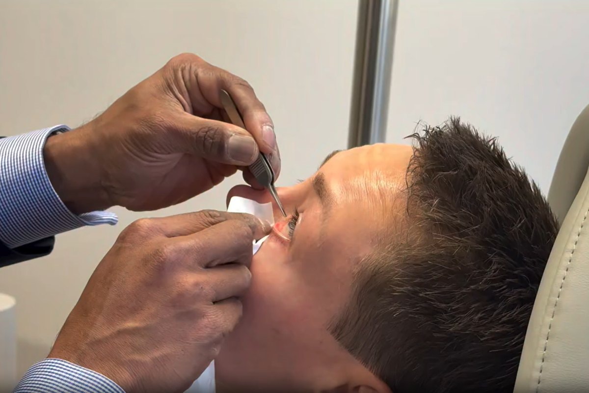 Lutadora retira tubo do olho após cirurgia causada por dedada em combate