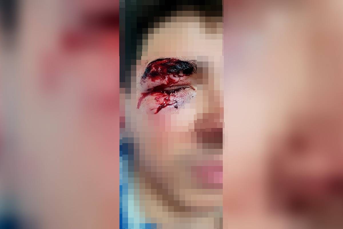 Da Asa Sul a Ceilândia: ataques em série de moradores de rua a pedestres apavora o DF