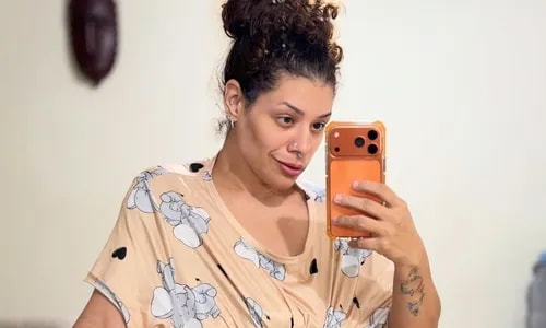 Aila Menezes mostra resultado de abdominoplastia e desabafa: ‘Vitória'