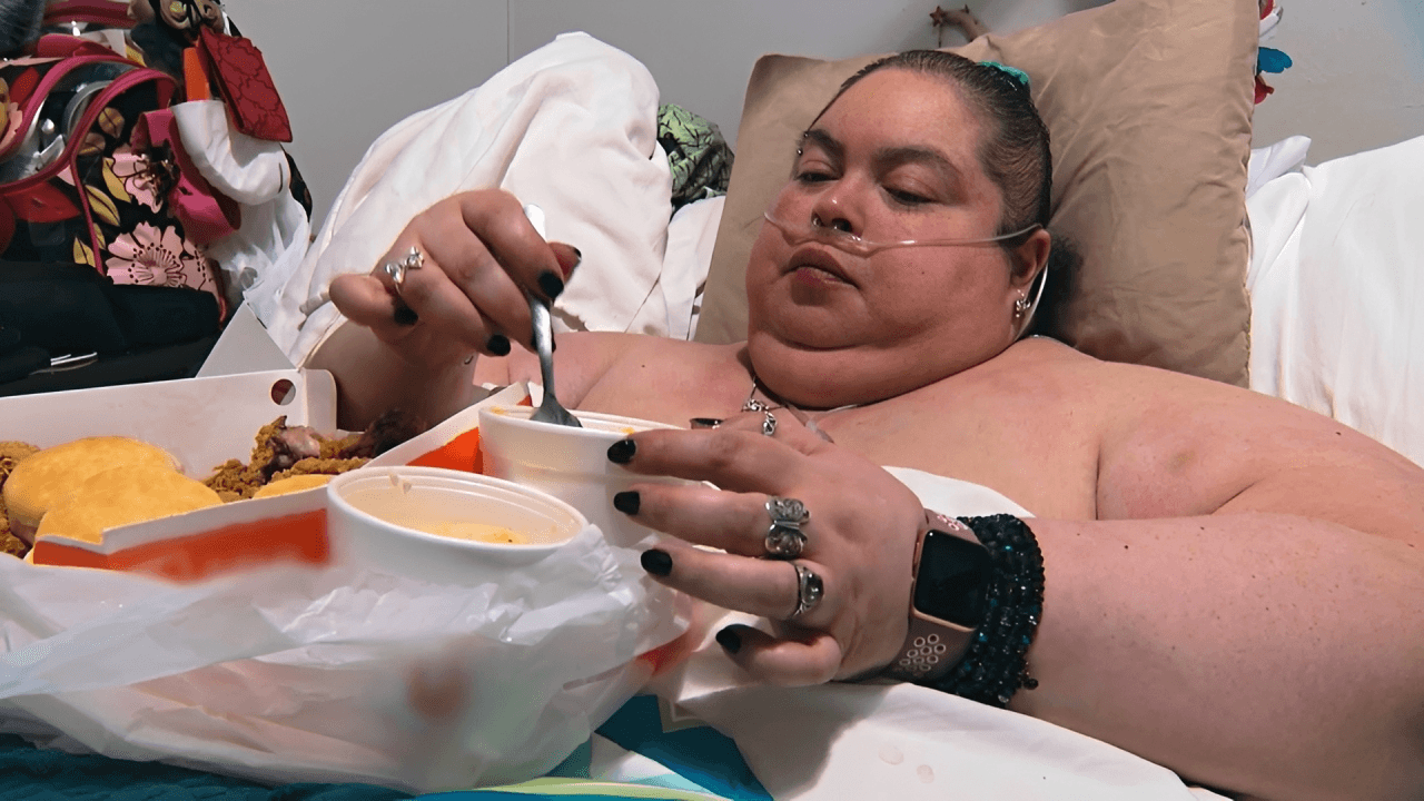 Lauren Pfeiff relata um ano de cirurgia de lipedema: “Impacto positivo”