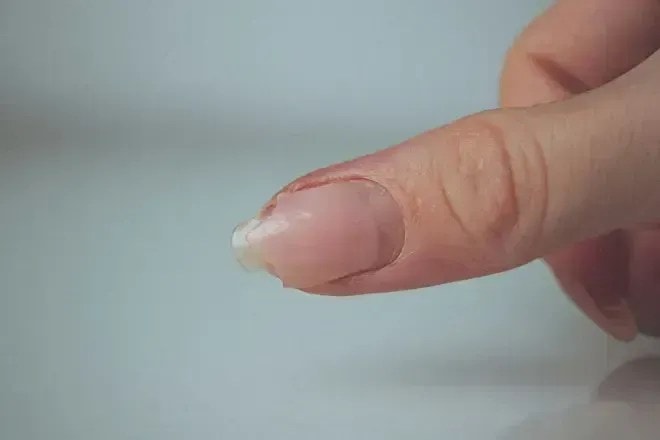 Como usar vaselina e hidratante para recuperar calcanhares e cotovelos ásperos no frio