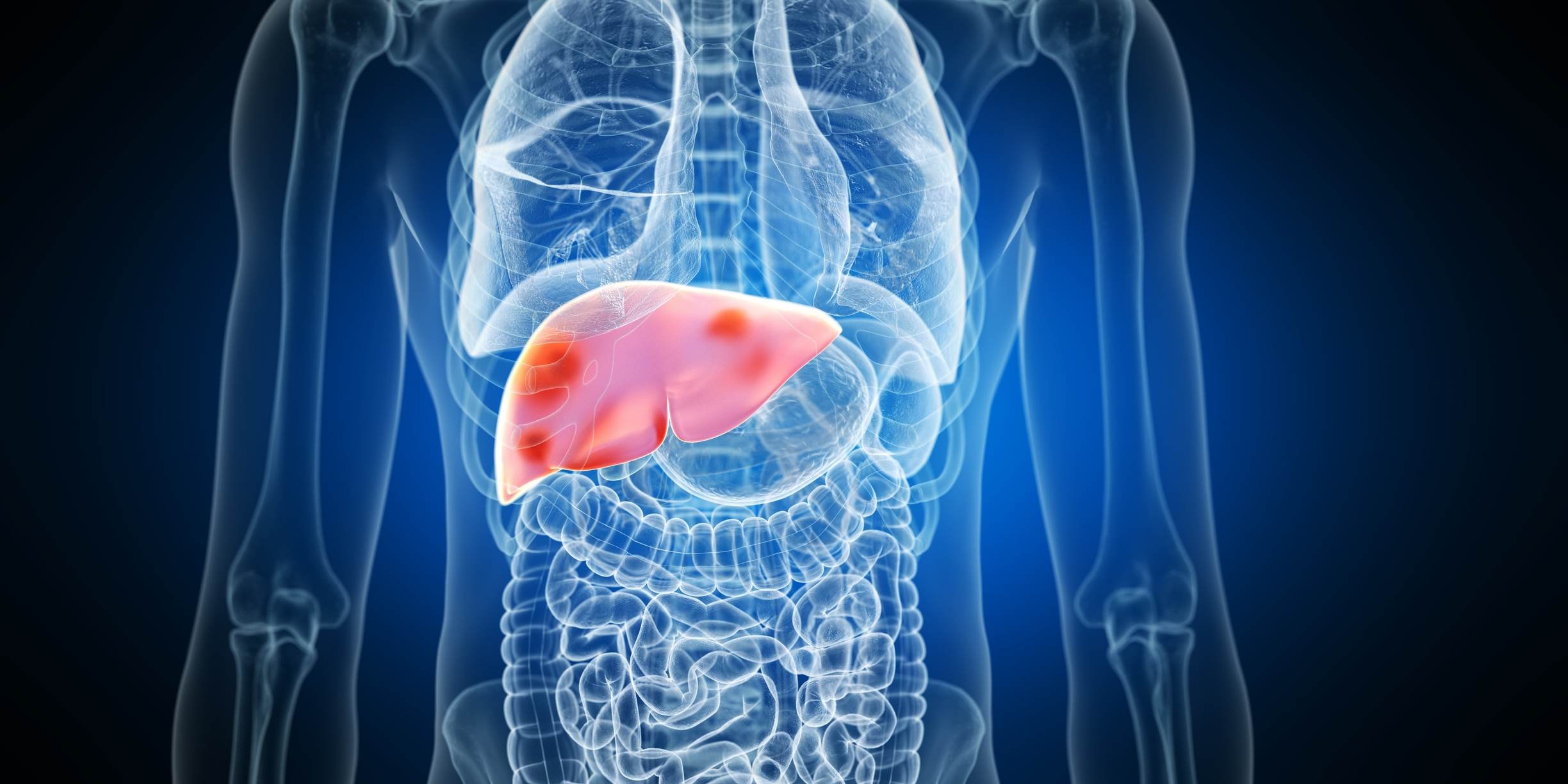 Testosterona para ganhar massa: quando busca por músculos arrisca saúde