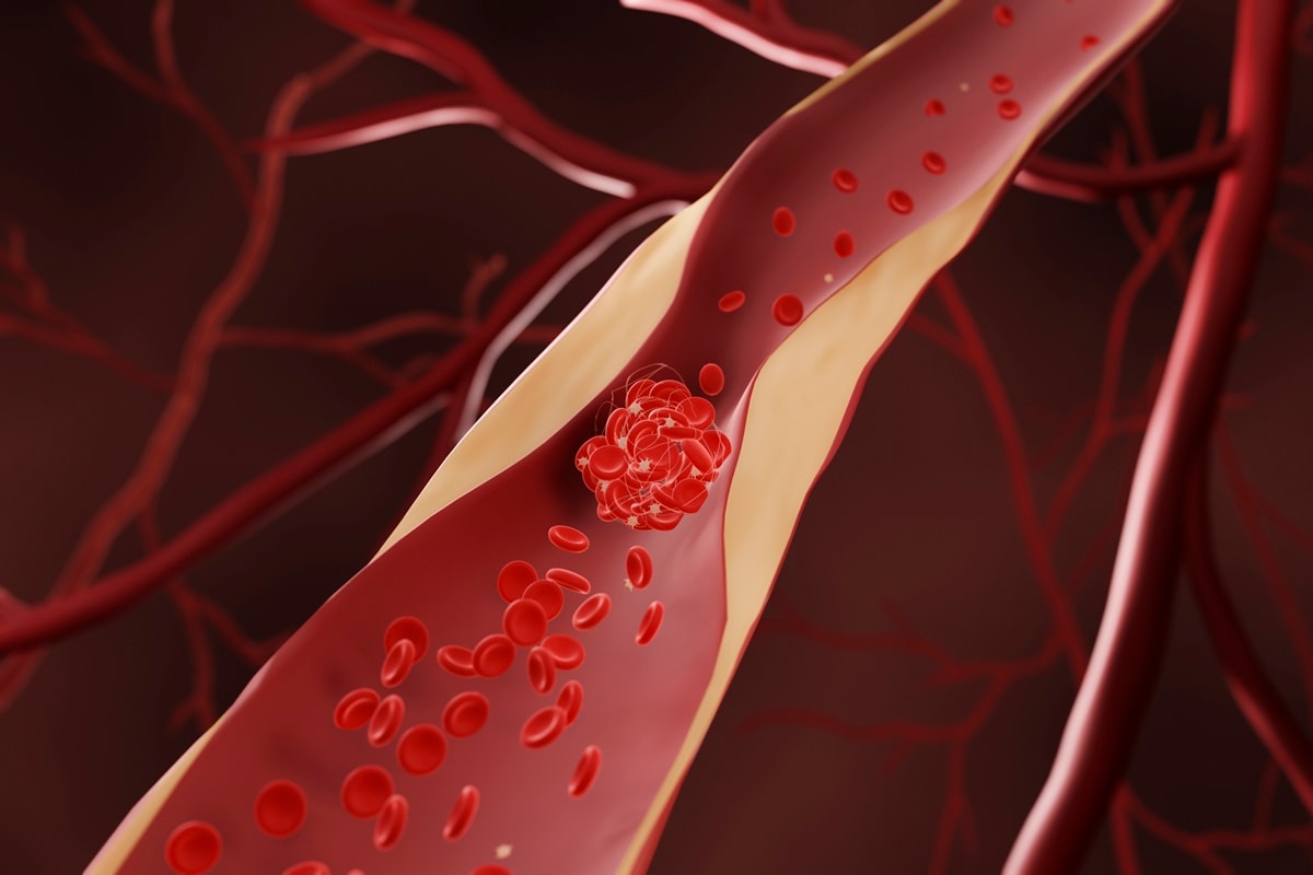 Sangue estraga? Saiba quanto tempo ele dura e como é reciclado