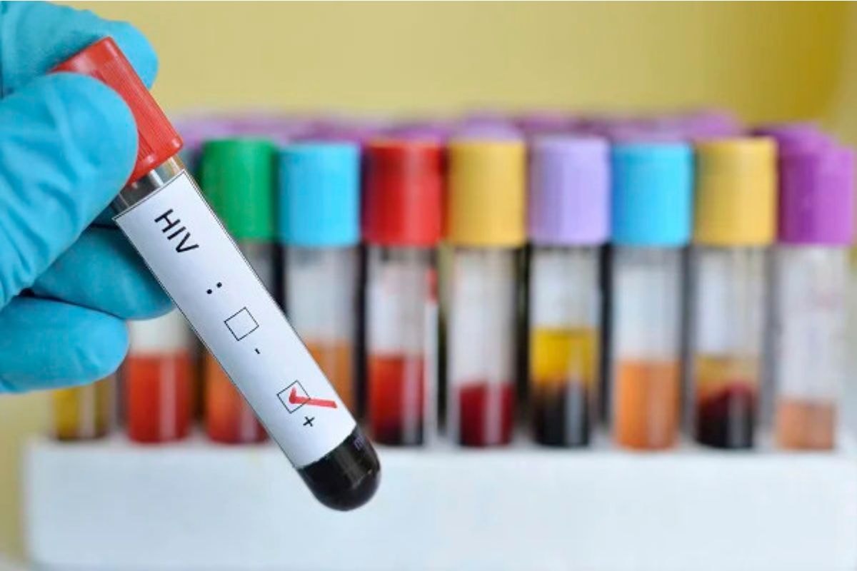 Dentista que transmitiu HIV de propósito para mulheres é denunciado