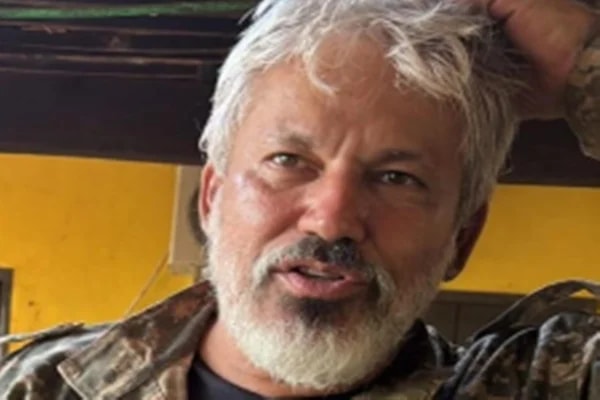 Da farda à plástica: veja antes e depois de coronel foragido da PMDF