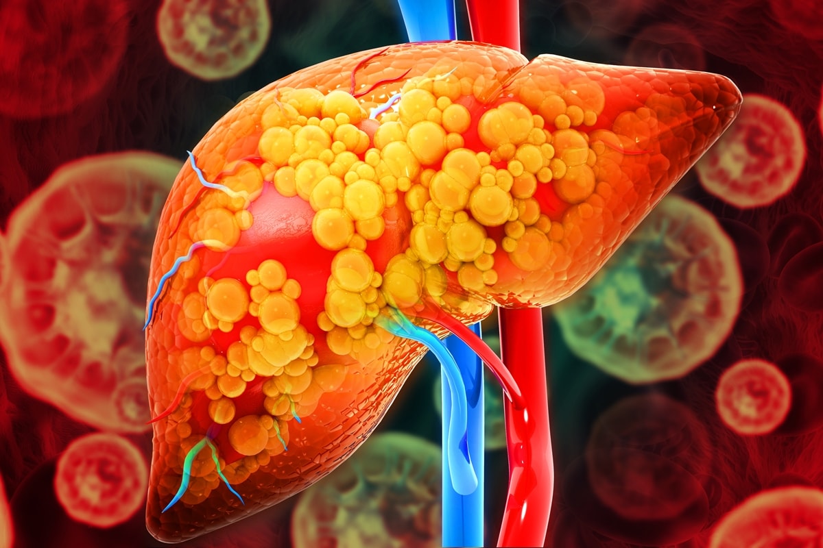 Gordura no fígado: nutri indica 10 alimentos que ajudam a prevenir o quadro