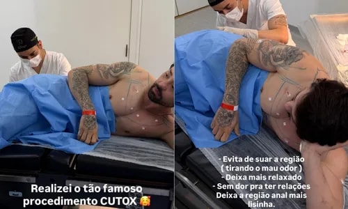 Du Cutox à lipo: Rico Melquíades choca com mais de 20 procedimentos estéticos no corpo; veja lista
