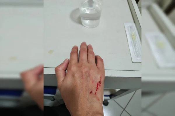 Enfermeira é agredida dentro de hospital público do DF