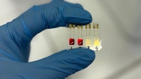 Superbactérias no intestino são identificadas em “teste de farmácia”