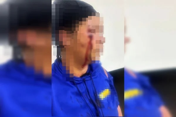 "Colocar pimenta no seu prikito", ameaçou agressora que chicoteou mulher