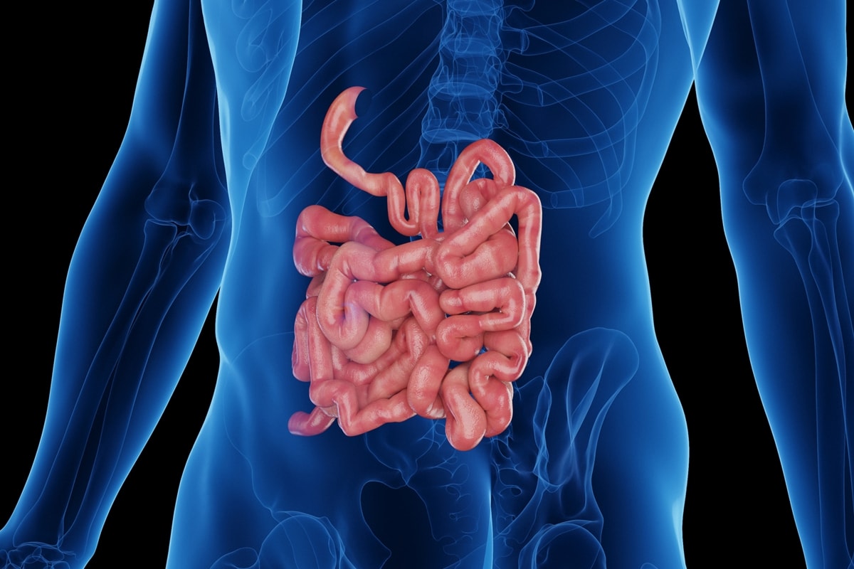 Coloproctologista cita alimentos com potencial de inflamar o intestino