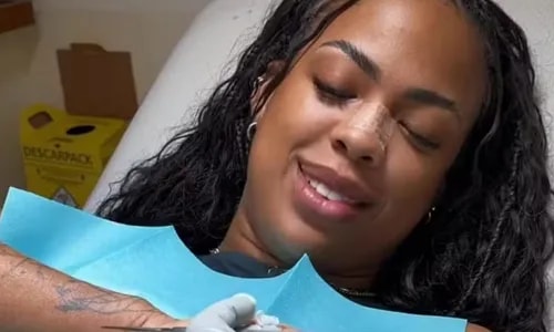 Marvvila faz cirurgia e retira sexto dedo da mão: 'Tchau'