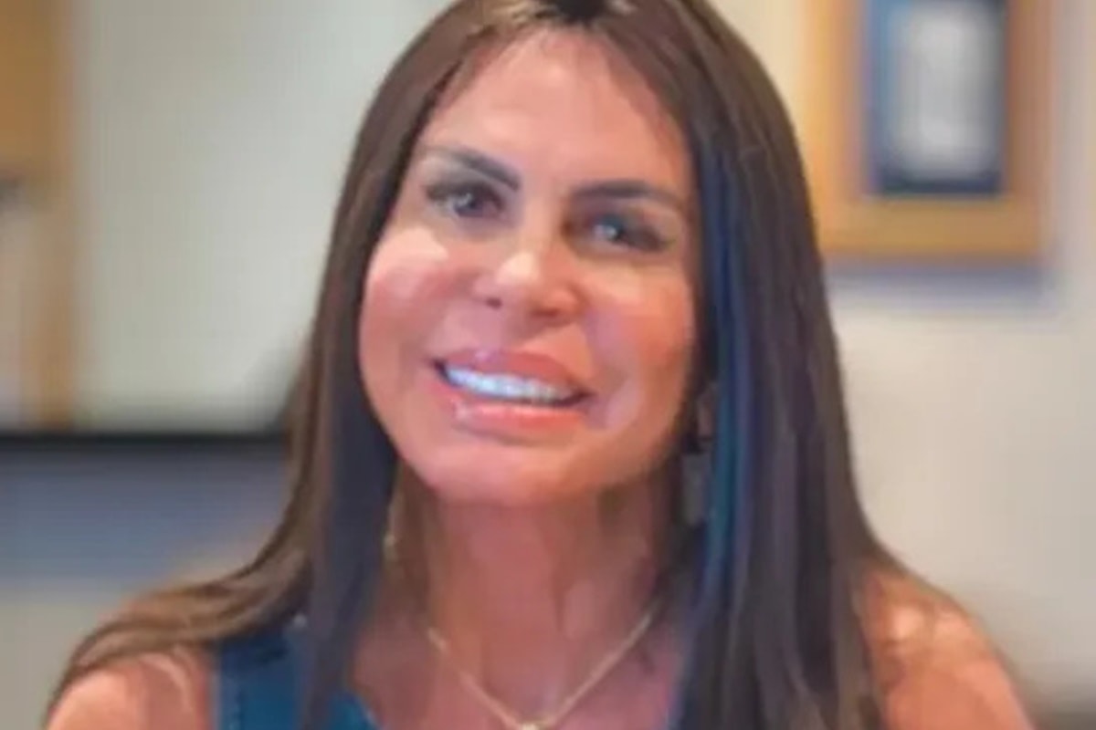 Gretchen aparece sem prótese capilar e revela causa de sua alopecia
