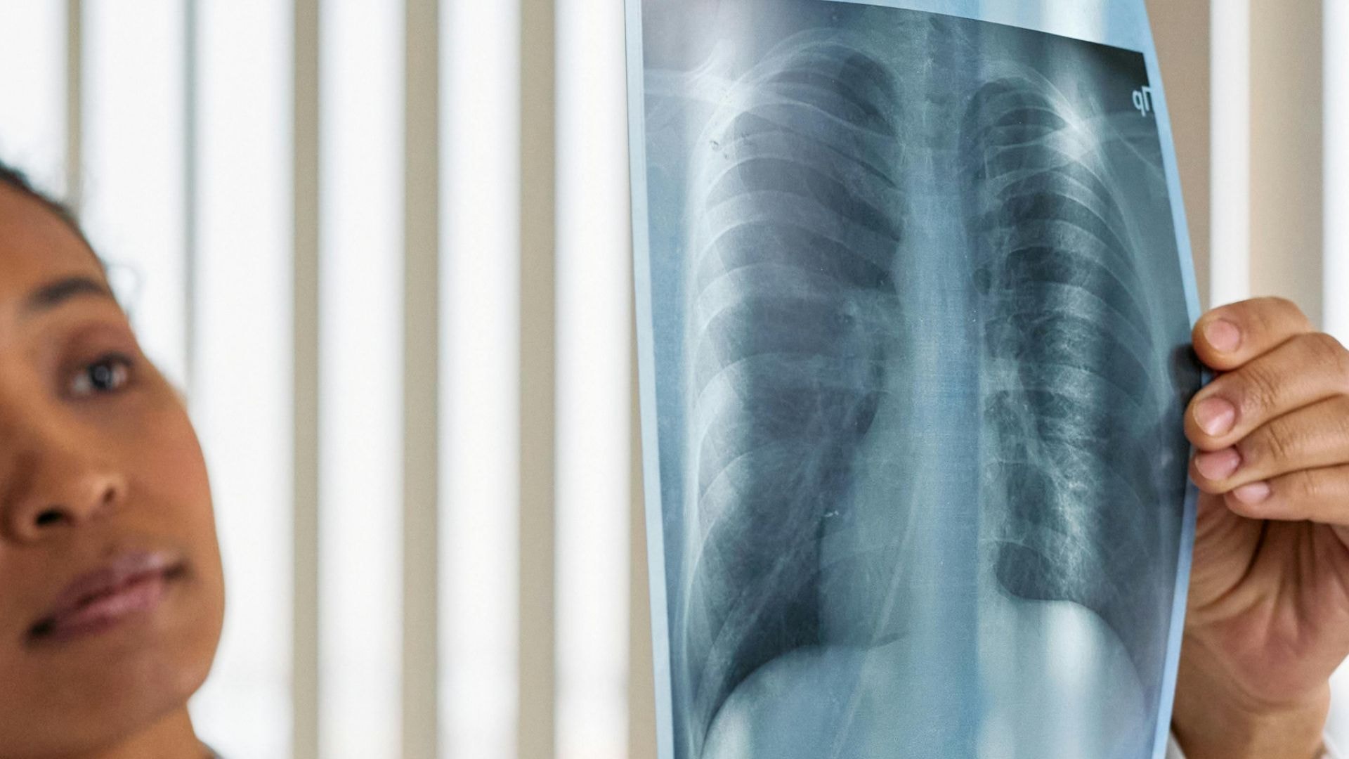 Ex-“The Voice Brasil” pede doações para custear tratamento de câncer