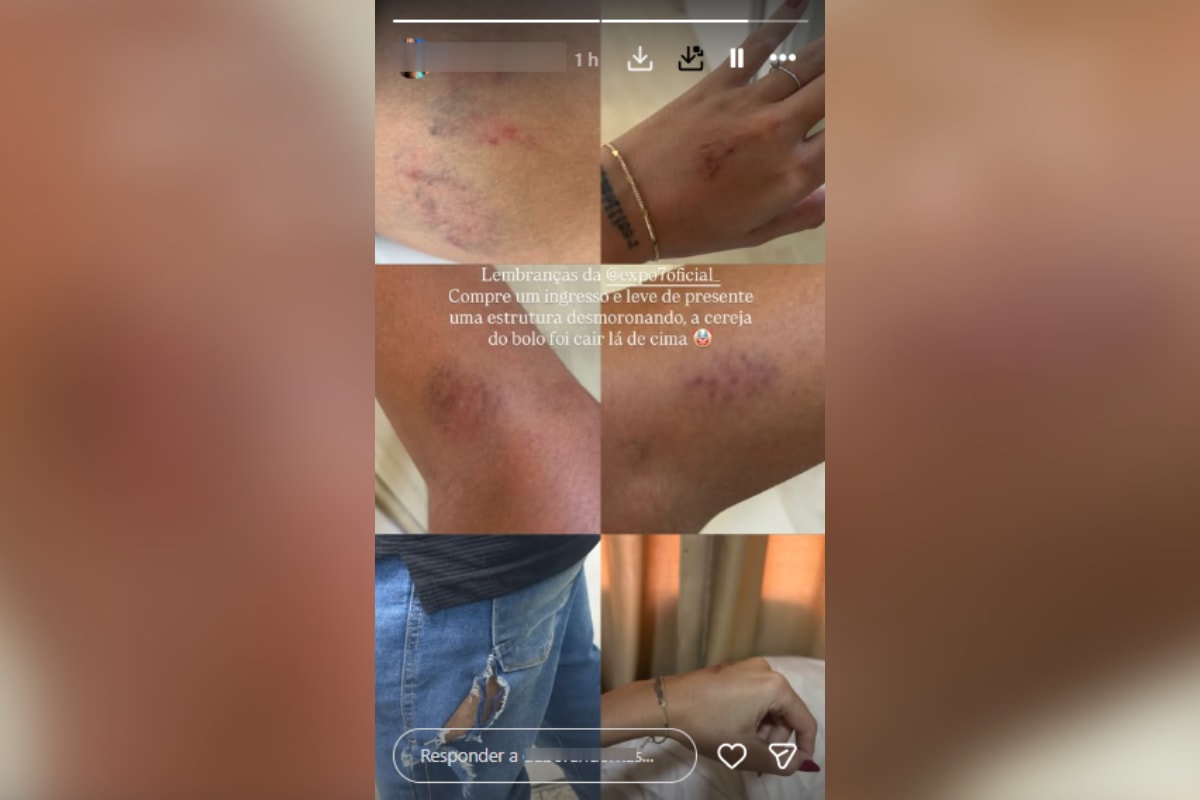 Estrutura desaba e deixa 12 feridos durante a Exposete em Sete Lagoas