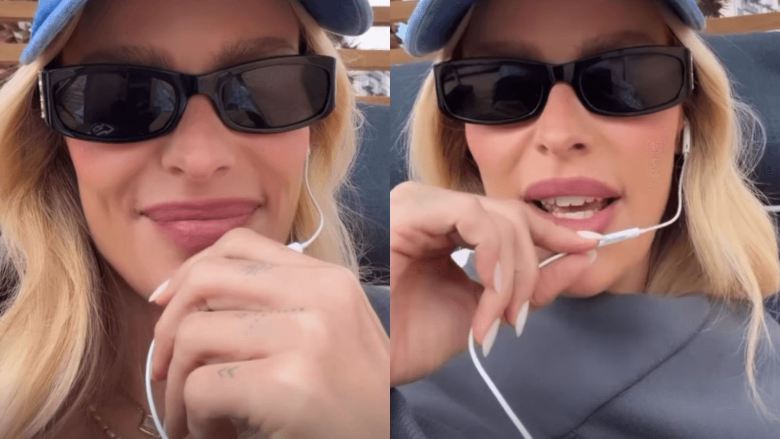 Yasmin Brunet relata crise de lipedema após comer glúten; entenda