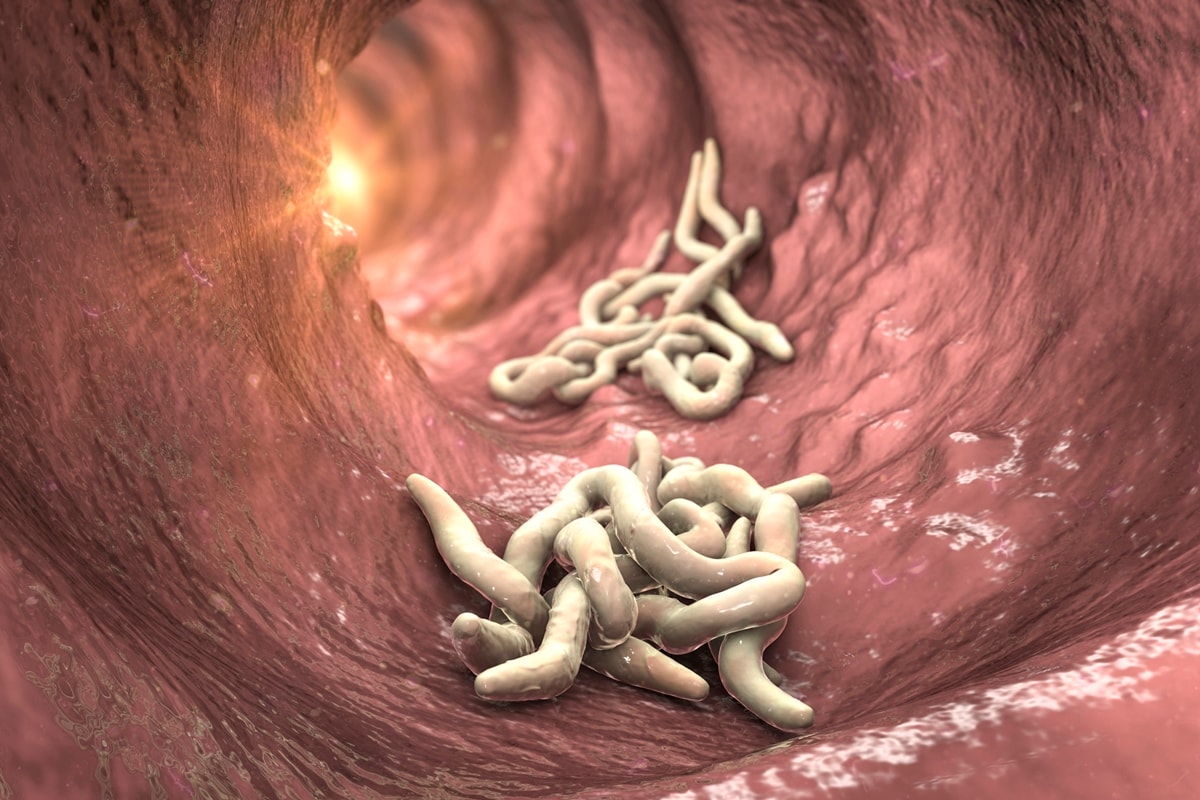 Gastroenterologista cita sinais que podem indicar vermes no intestino