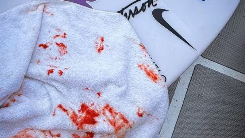 Jogadores de críquete do Nepal fazem alerta após avalanche atingir o país