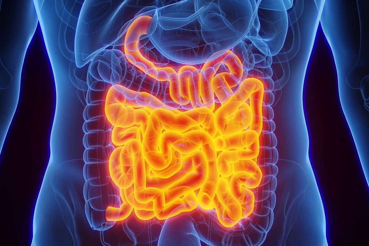 Câncer de intestino: saiba quais são os principais sintomas da doença