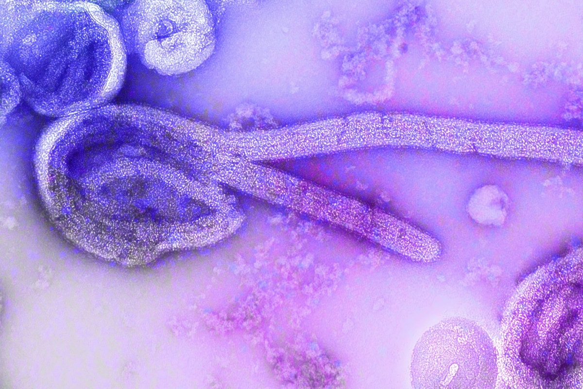 Suspeita de Ebola em SP: paciente isolado foi atendido em estado grave