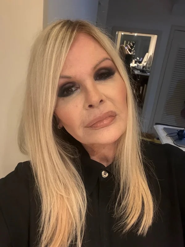 Monique Evans faz cirurgia no rosto e revela: "Não me reconheceram"