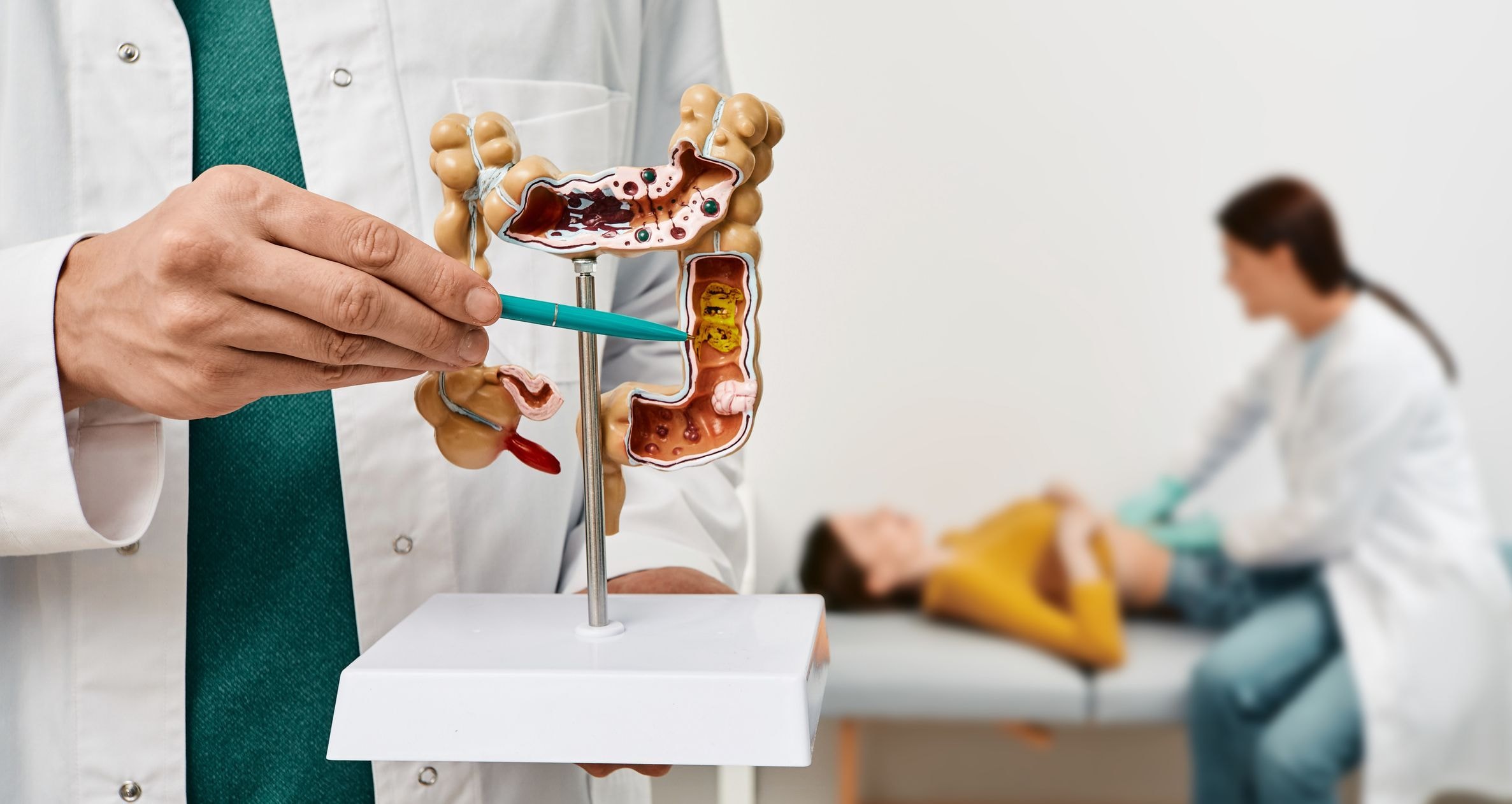Câncer colorretal: médica alerta para sintomas e diagnóstico tardio