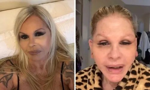 Monique Evans surge irreconhecível após cirurgia e faz revelação