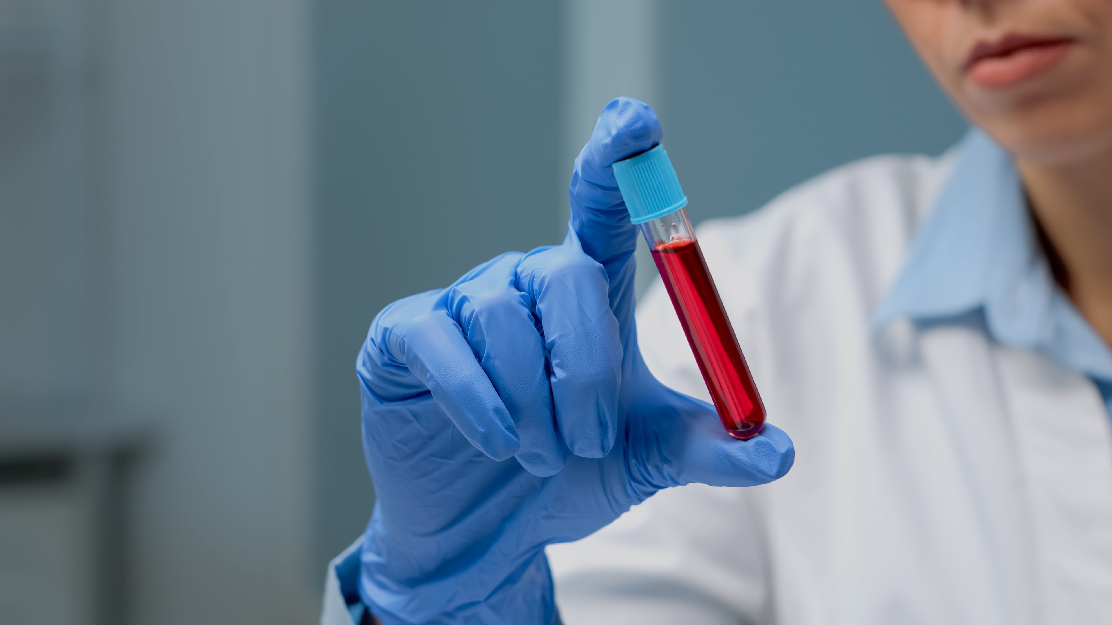 Projeto de lei: especialista avalia benefício do cordão roxo para Alzheimer