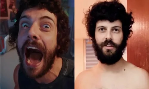 Diogo Defante exibe mudança radical no corpo após retirada de tumor