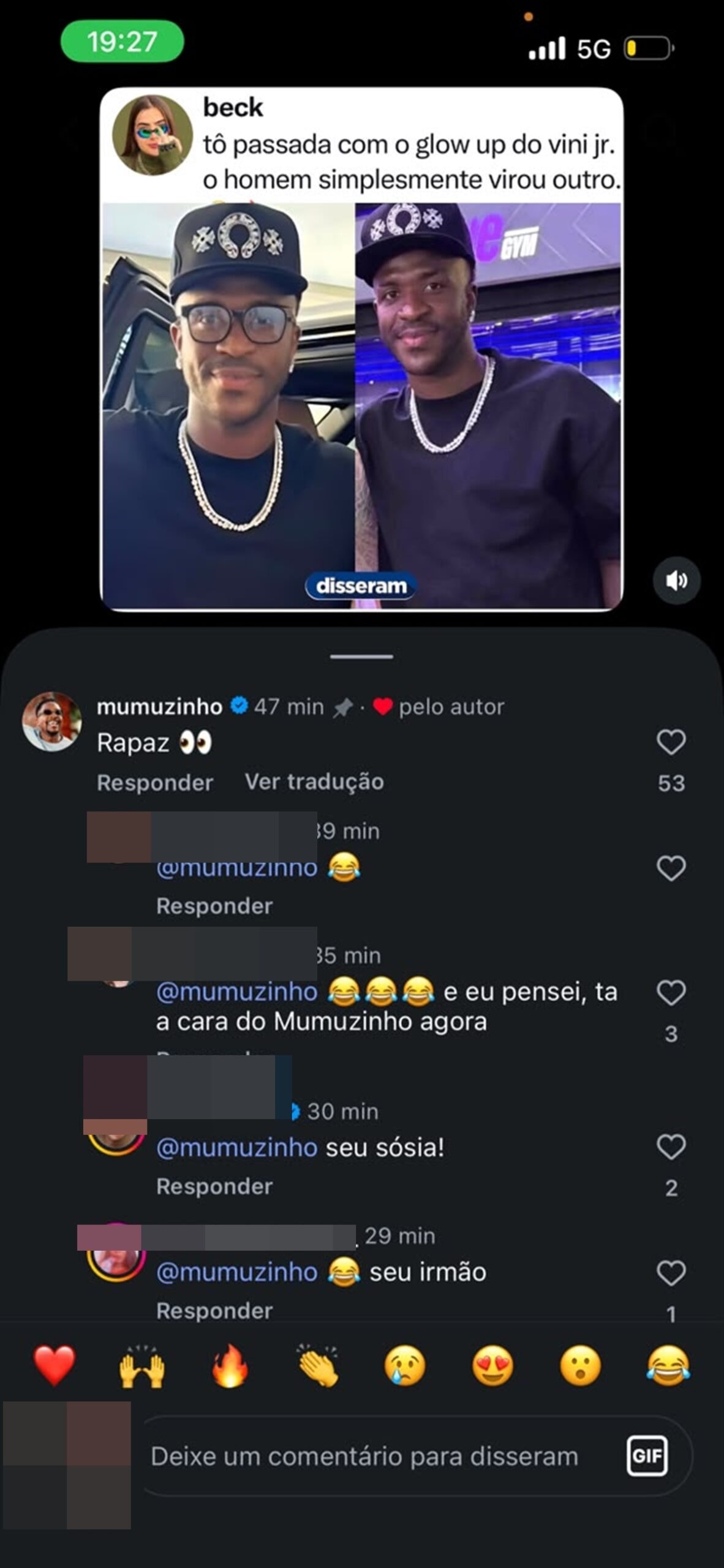 Mumuzinho reage a comparações com Vini Jr. após procedimento estético