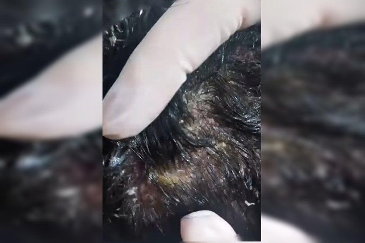 Larvas na cabeça: pais presos por maus-tratos barraram assistente social