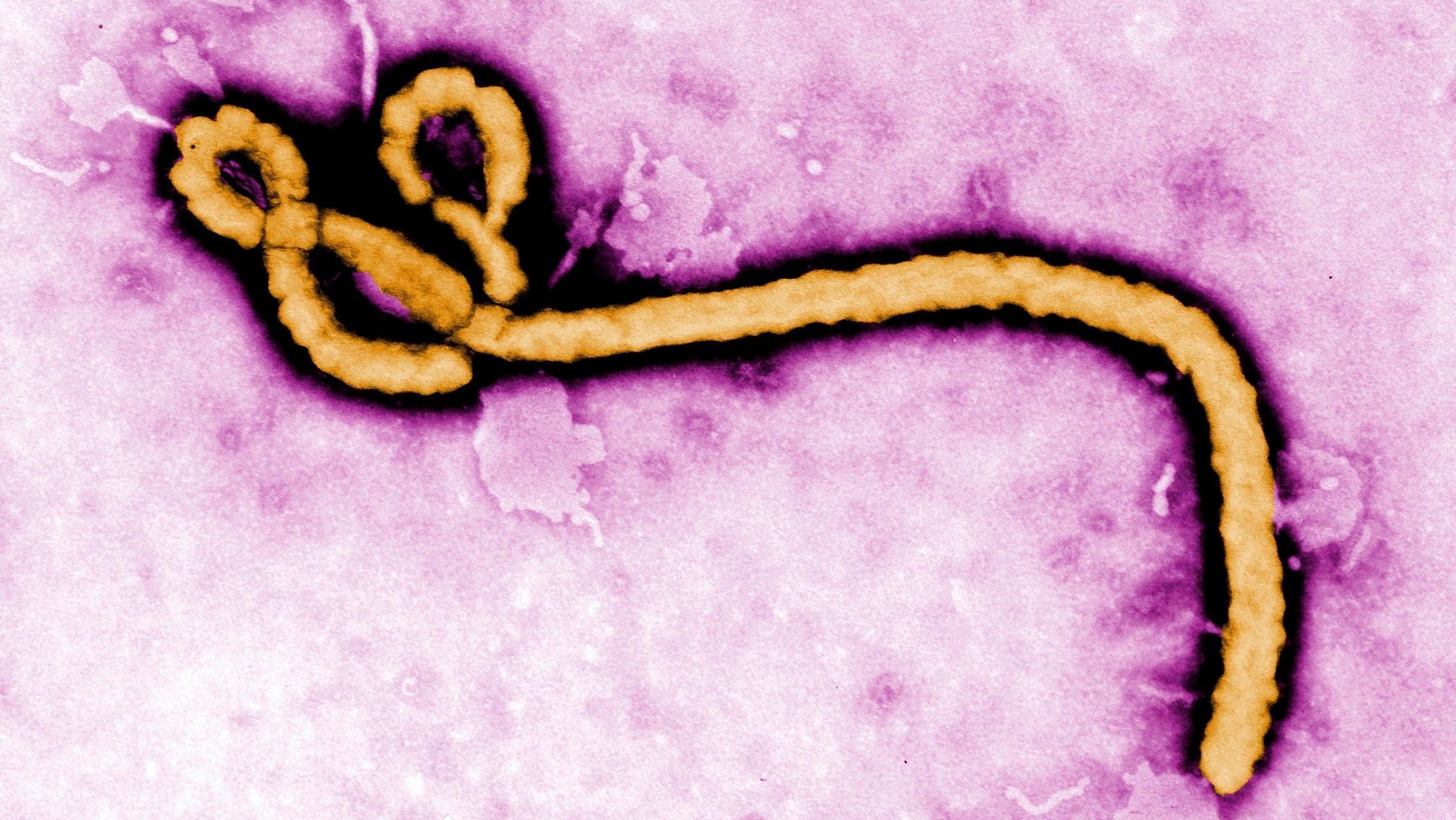 Suspeita de Ebola no Brasil: risco de contágio da doença é baixo?