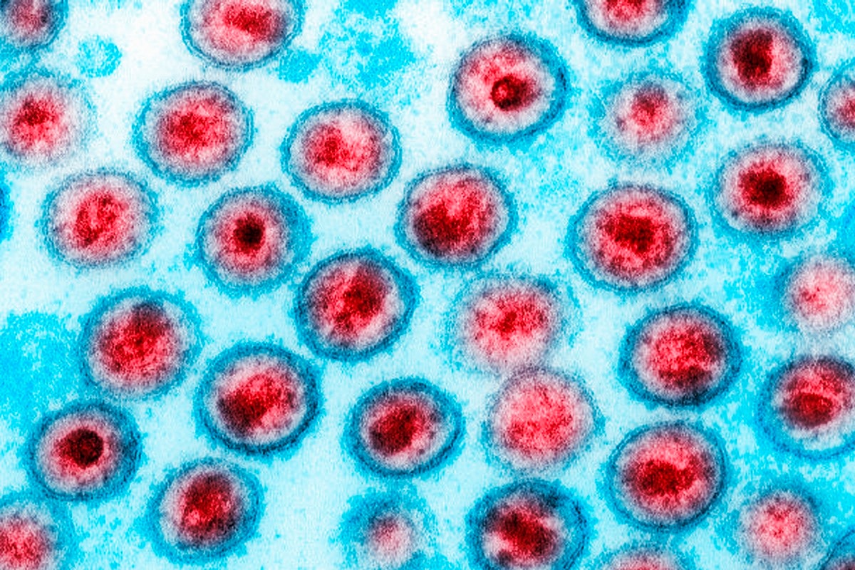 STM cassa posto e patente de militar que transmitiu HIV a 2 mulheres
