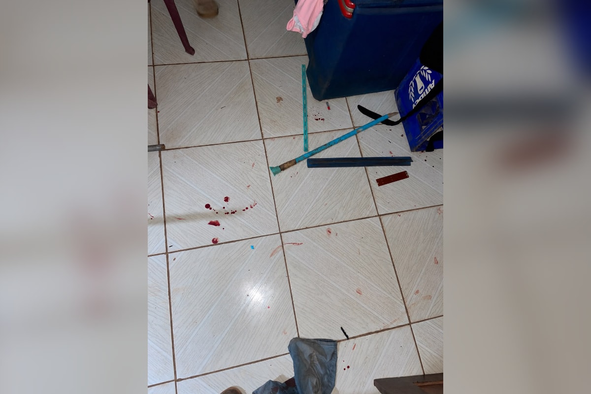 Pais quebram rodo na cabeça de bebê de 10 meses em briga por piercing