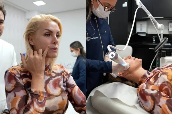 Ana Hickmann faz procedimento estético antes de casamento com Edu Guedes