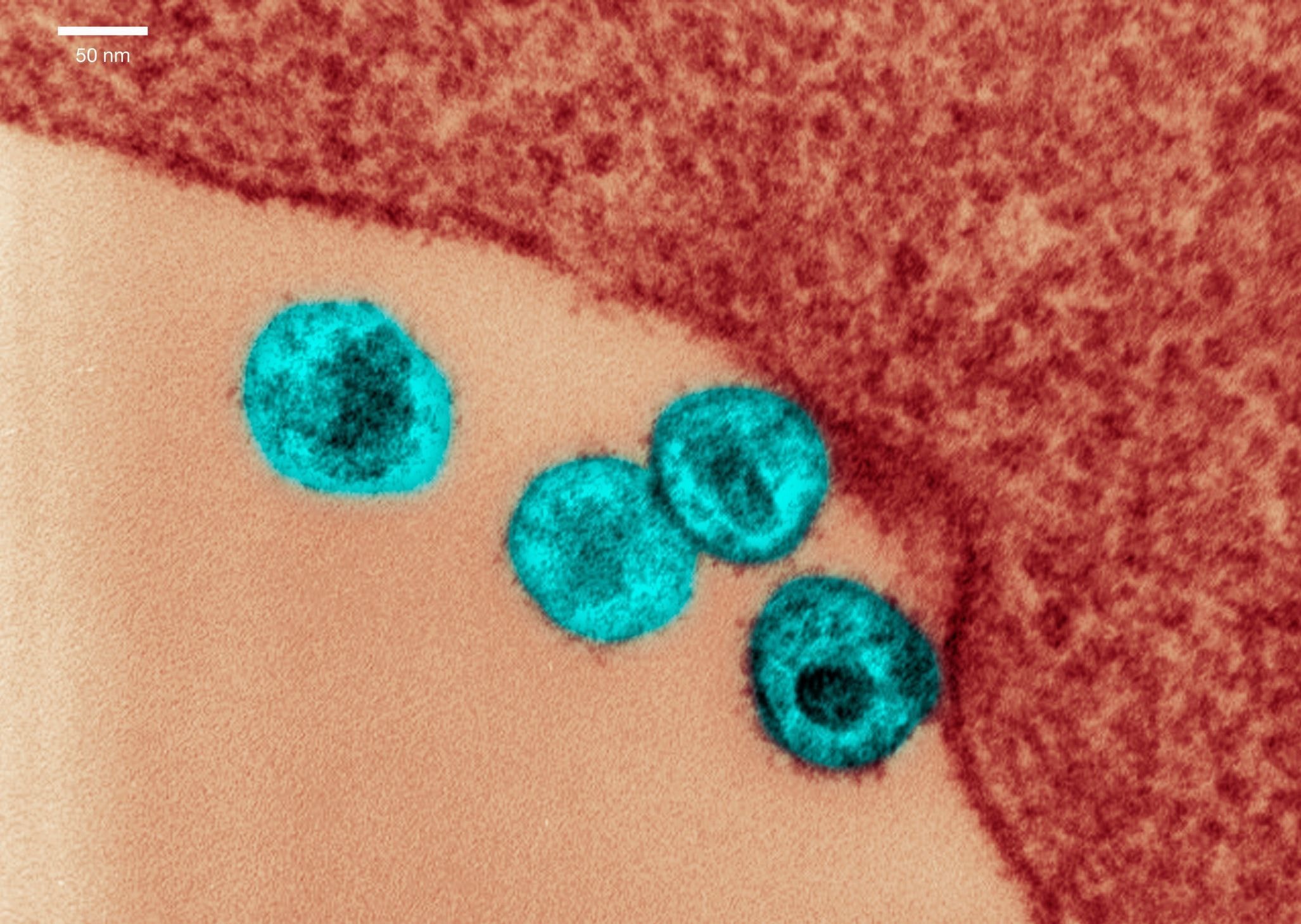 MPRJ pede condenação dos seis réus em caso de transplantes com HIV