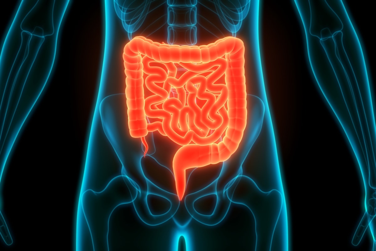 Estudo descobre como bactéria intestinal pode favorecer câncer de cólon